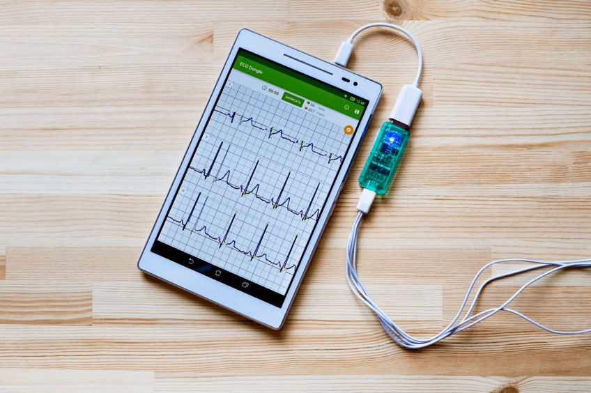 ОЭЗ «Дубна» начала выпуск лицензированных портативных кардиографов